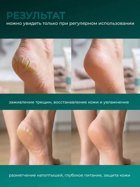 Крем для ног MANITA PROFESSIONAL Крем для ног MENTOL + UREA 460 мл